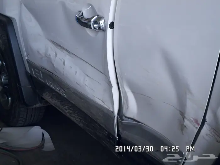 شفط البودي وتعديل الصدمات (17)  4