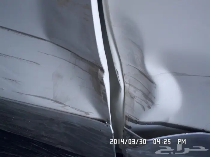 شفط البودي وتعديل الصدمات (17)  3