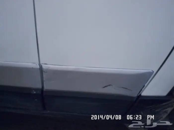 شفط البودي وتعديل الصدمات (17)  14