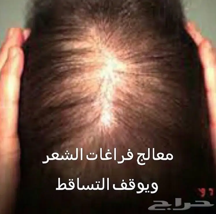 He الحل الامثل لفراغات الشعر والذقن (image 73)