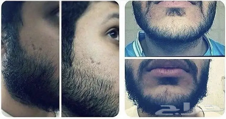 GG الزيت العجيب لحل مشاكل الشعر والدقن والشار (image 111)