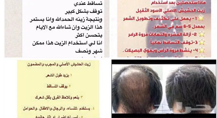 DD: الحل الأمثل لتكثيف وشعر كثيف! (image 27)