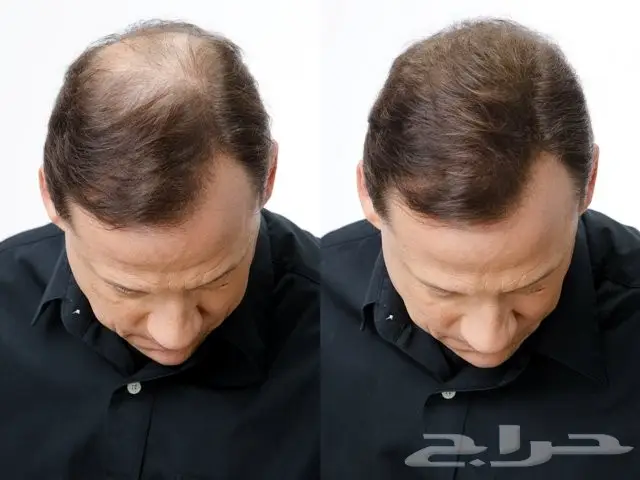 S الزيت العجيب لحل مشاكل الشعر والدقن والشارب (image 28)