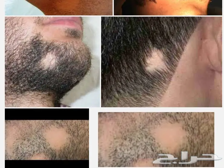 6l افضل زيت لإنبات وتطويل الشعر  (image 33)