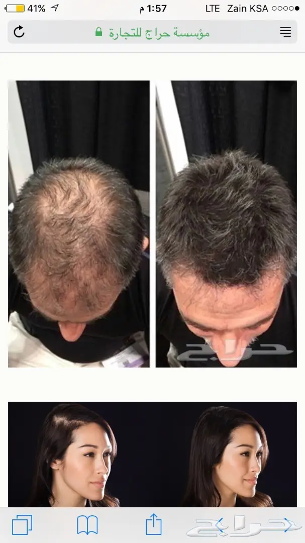 اختراع رهيب لي اخفاء الصلع فثواني (image 4)