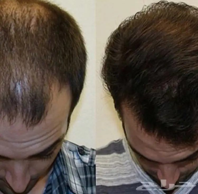 افضل زيت لإنبات وتطويل الشعر H (image 78)