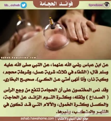 الحجامة معجزة الطب النبوي  (image 2)