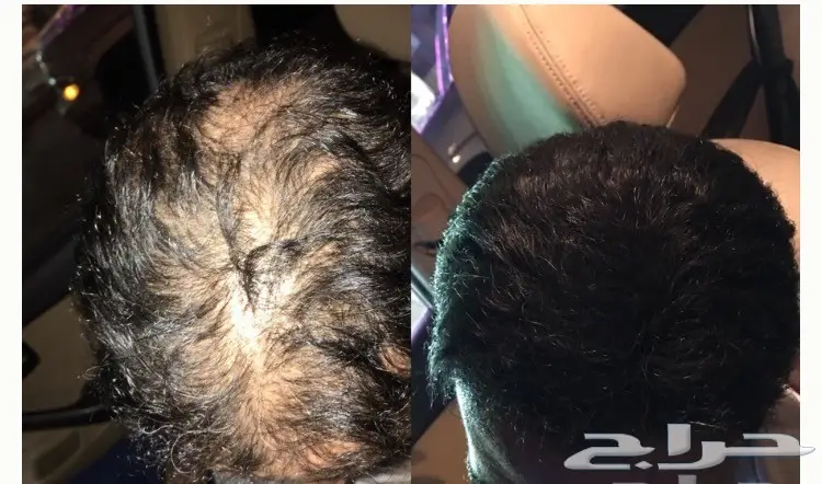 عرض نهايةالسنة اشتري 2 الياف والثالث مجانا (image 8)