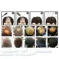 ألياف للصلع(تصفية أشتري 2 والثالث مجانا)  (image 30)