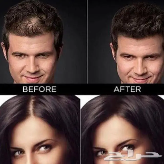 ألياف للصلع(تصفية أشتري 2 والثالث مجانا)  (image 20)