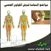 الخميس 17 احسن وقت للحجامة النبوية