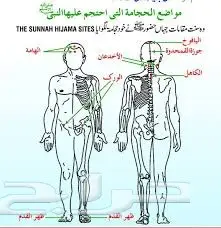 الخميس 17 احسن وقت للحجامة النبوية (image 3)