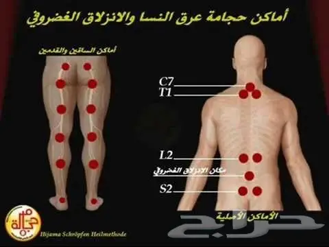 الخميس 17 احسن وقت للحجامة النبوية (image 2)