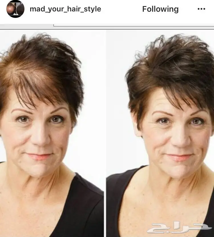 الياف للصلع(تصفيه اشتري 2 والثالث مجانا). (image 11)