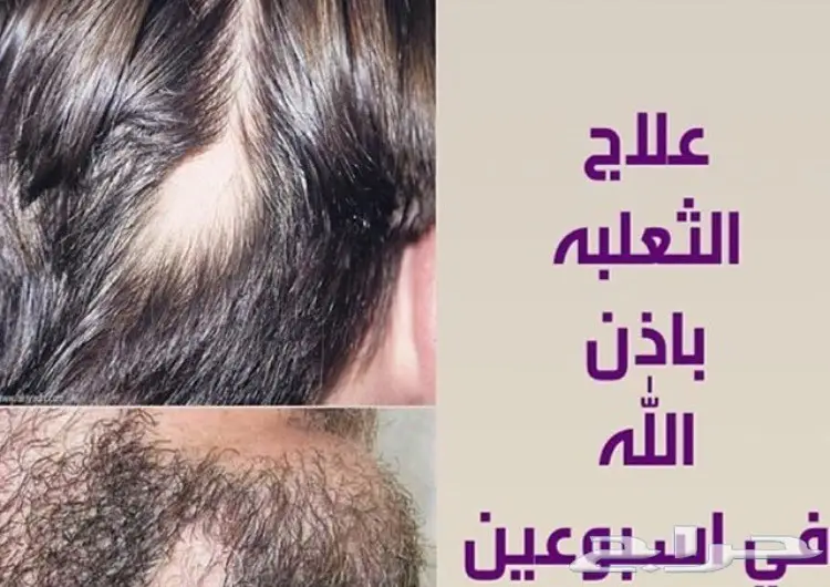  _ لحل مشاكل الشعر والدقن والشارب مجرب ومضمون (image 99)