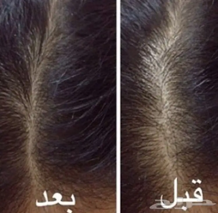 _ لحل مشاكل الشعر والدقن والشارب مجرب ومضمون (image 122)
