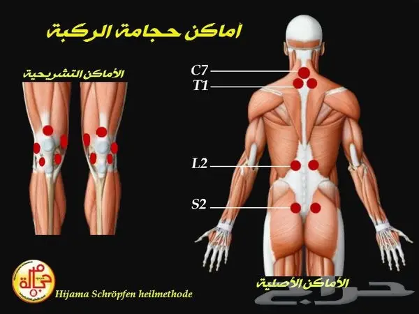 اليوم 19 منافضل اوقات الحجامة (image 1)