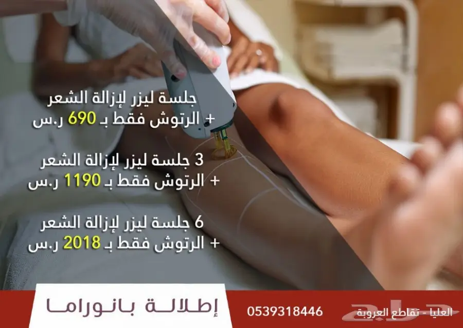 عرض مميز على ليزر ازالة الشعر الجسم