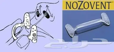  مانع الشخير البريطانى بلاستك طبي قطعتين (image 8)