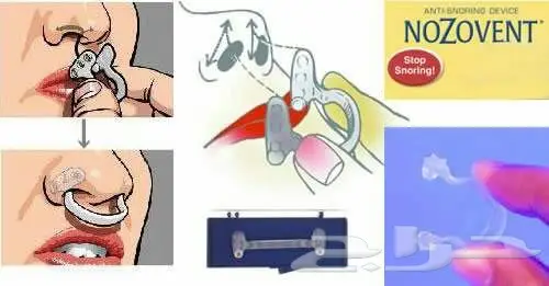  مانع الشخير البريطانى بلاستك طبي قطعتين (image 7)