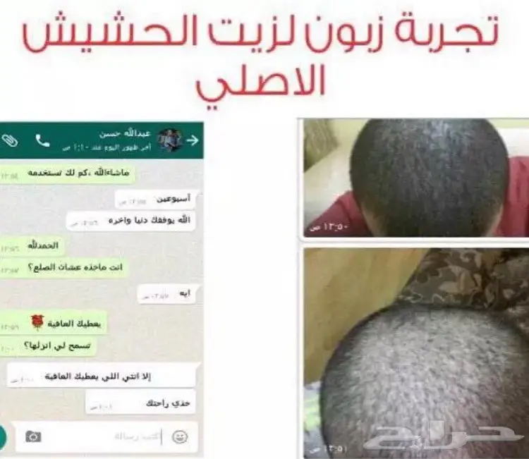 .. V لدينا الحل لإنبات الشعر وتطويله وتكثيفه (image 120)