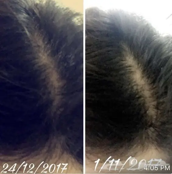 قطرات كيربروست الاصليه لتطويل الرموش  (image 4)