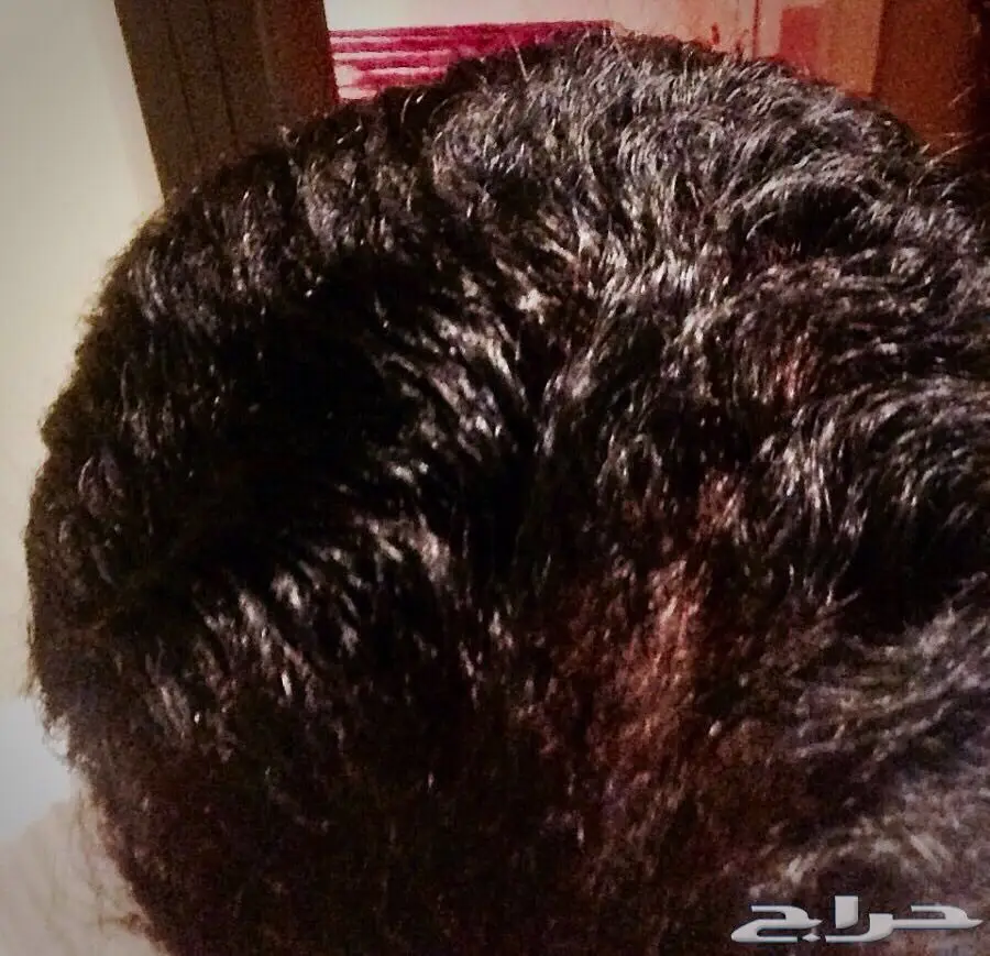  طريقة ممتازة ومجربة لتكثيف الشعر (image 3)