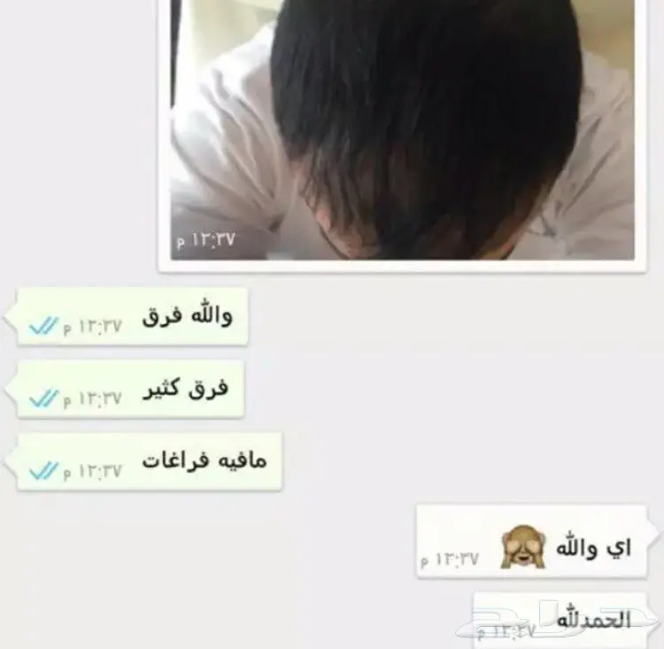 الحل الامثل لفراغات الشعر والذقنo (image 51)