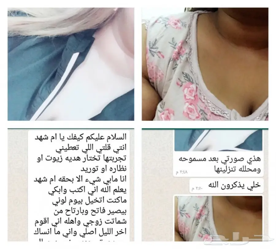 تبييض البشرة - نتائج مذهلة في أسبوع! (image 7)