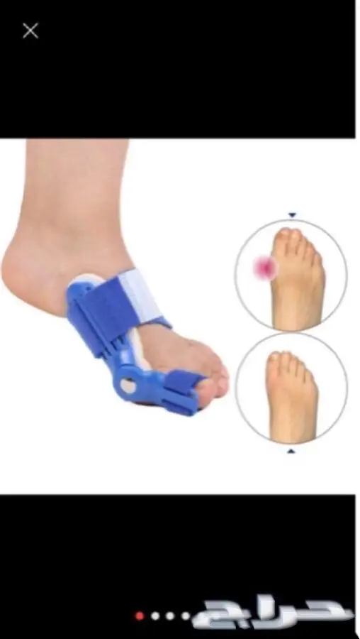 تقويم الأقدام والأصابع - راحة فائقة وتصحيح مثالي!