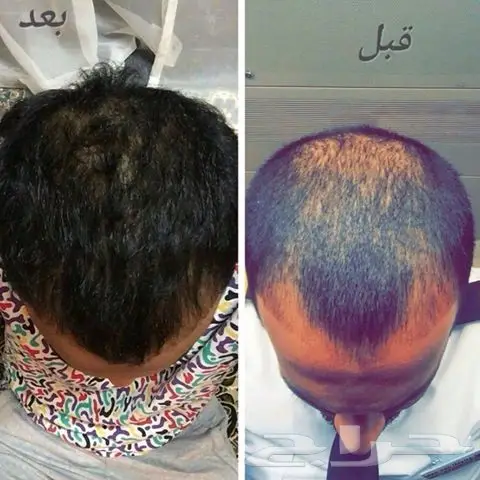 تطويل الشعر السريع والفعال! (image 33)