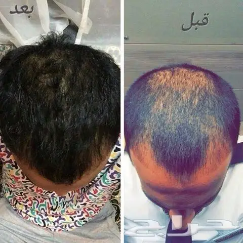 حصريا الزيت الافغاني الاصلي  (image 5)