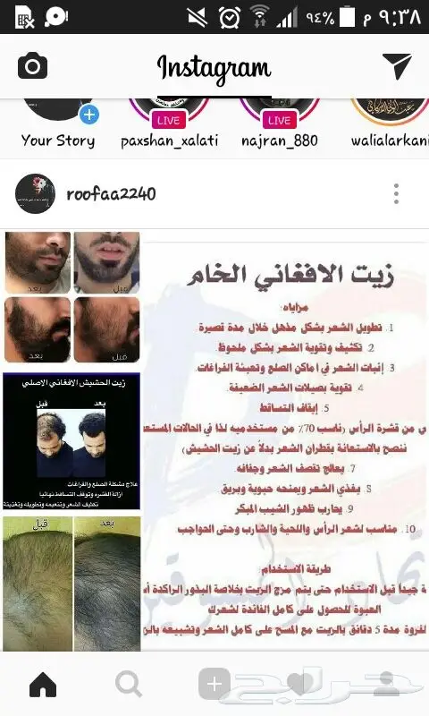 الزيت لافغاني حل جميع مشاكل الشعر