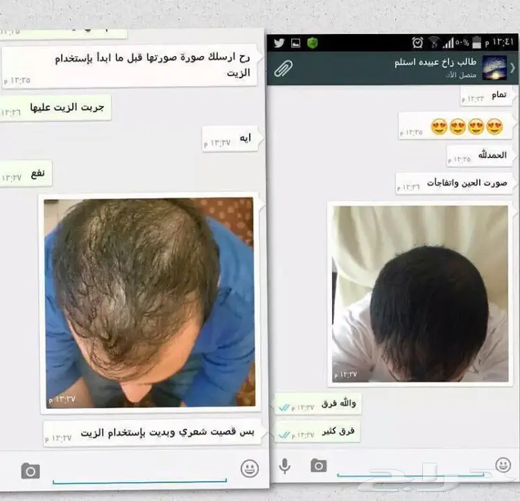 الزيت العجيب لحل مشاكل الشعر والدقن والشاربs (image 18)