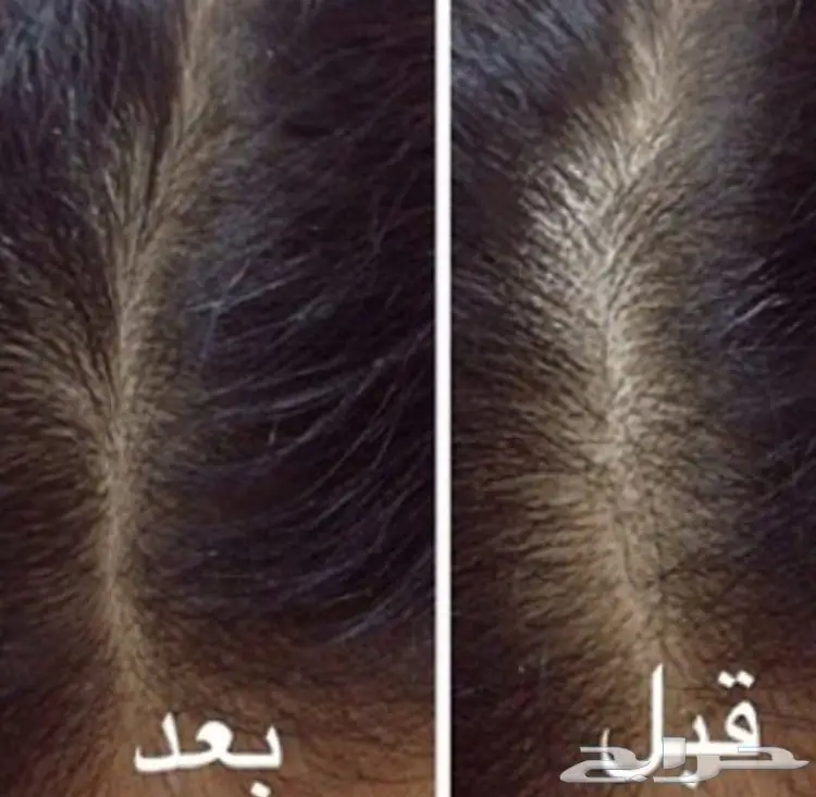 حصريا الزيت الافغاني الاصلي  (image 27)