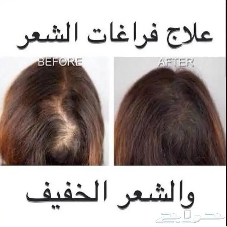 حصريا الزيت الافغاني الاصلي  (image 14)