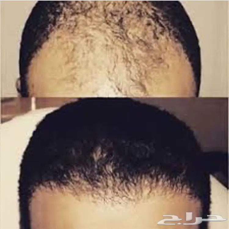 حصريا الزيت الافغاني الاصلي  (image 35)