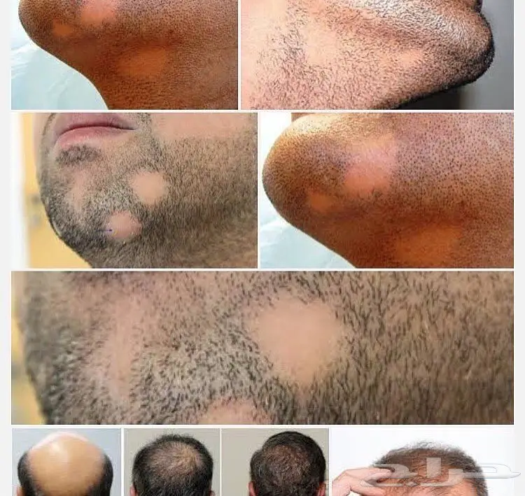 المنتج الاول للشعر  (image 75)