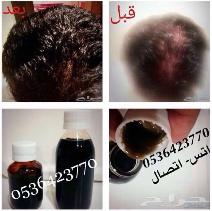 تطويل الشعر وتقويته - وصفة طبيعية مجربة!