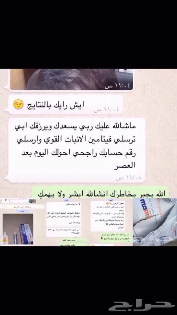 منبت الصلع والفرغات والتساقط مضمون وامن (image 17)