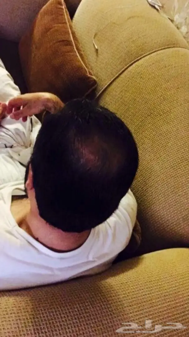 منبت الصلع والفرغات والتساقط مضمون وامن (image 32)