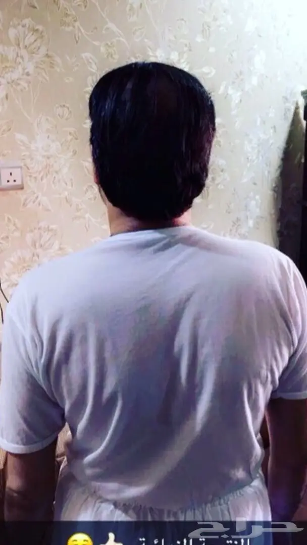 منبت الصلع والفرغات والتساقط مضمون وامن (image 33)