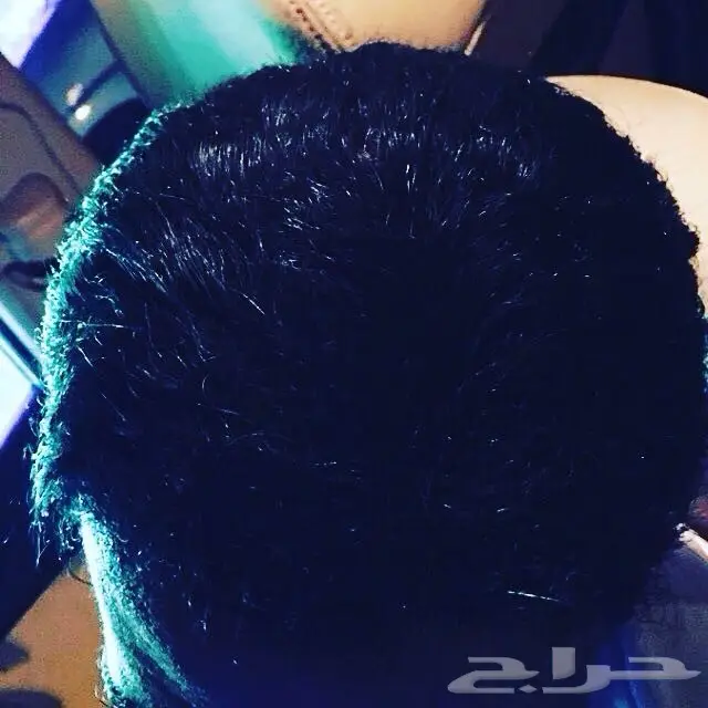 منبت الصلع والفرغات والتساقط مضمون وامن (image 3)