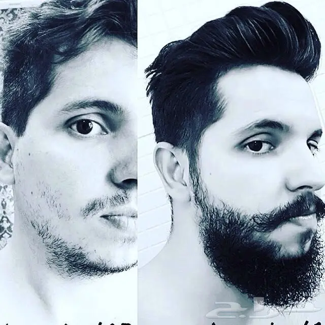 منبت الصلع والفرغات والتساقط مضمون وامن (image 24)