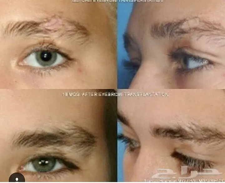 قطرات كيربروست العالميه اوفر الاصلية (image 9)