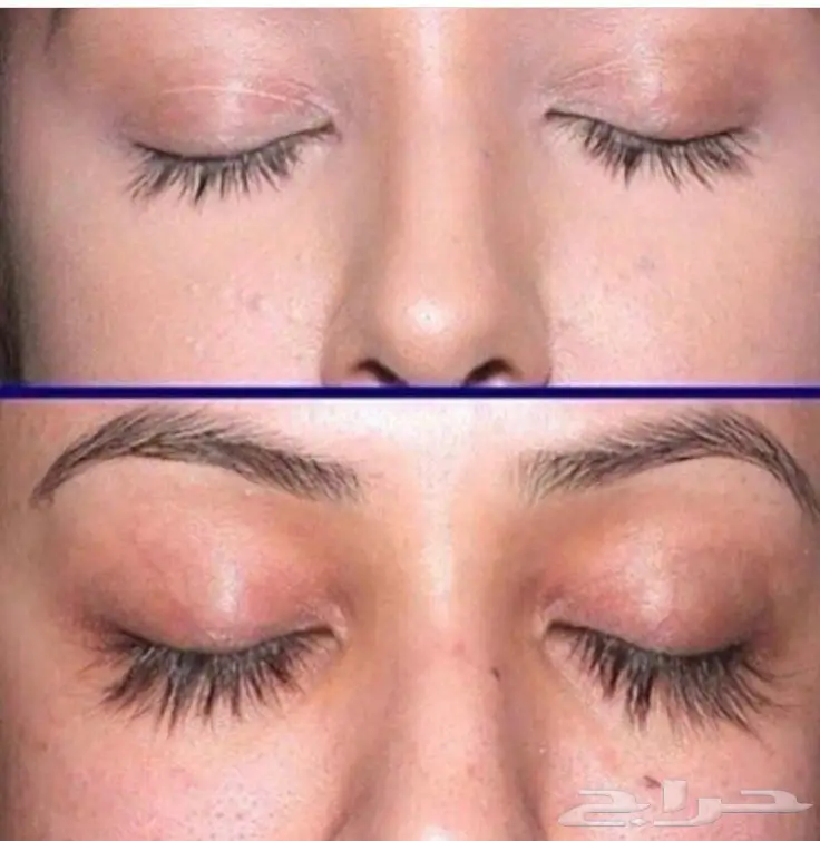 قطرات كيربروست العالميه اوفر الاصلية (image 4)