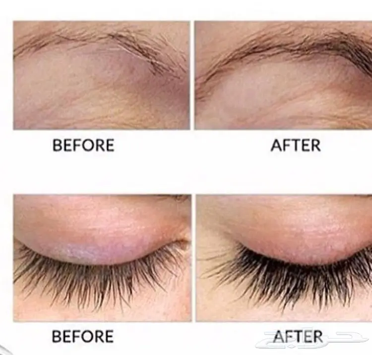 قطرات كيربروست العالميه اوفر الاصلية (image 6)