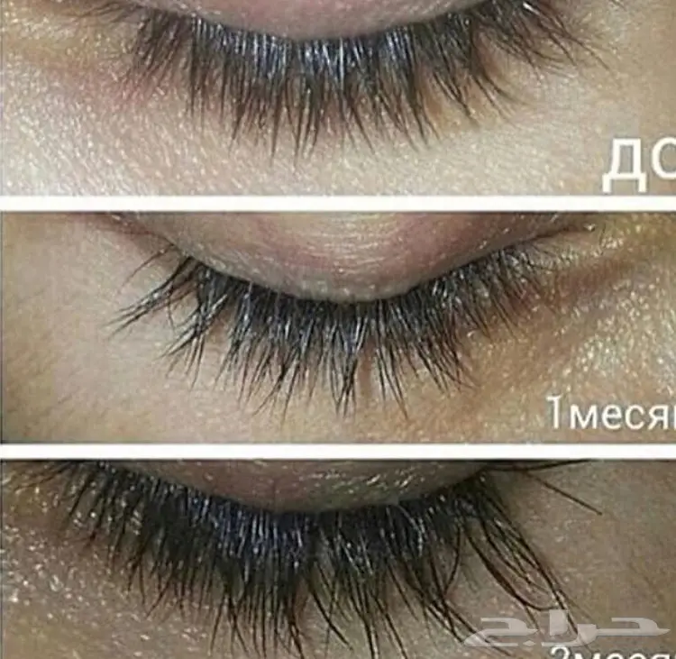 قطرات كيربروست العالميه اوفر الاصلية (image 7)