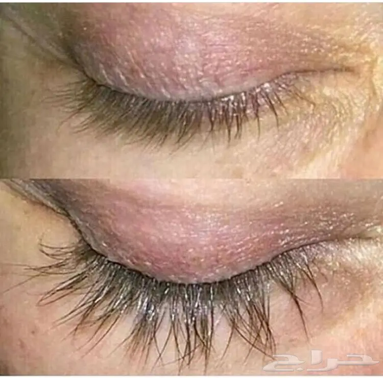 قطرات كيربروست العالميه اوفر الاصلية (image 5)