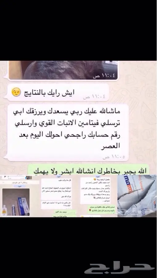 منبت الشعر والصلع الوراثي والفرغات  (image 25)